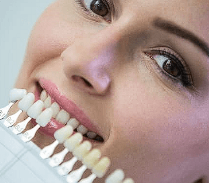 Lentes de Contato Dental