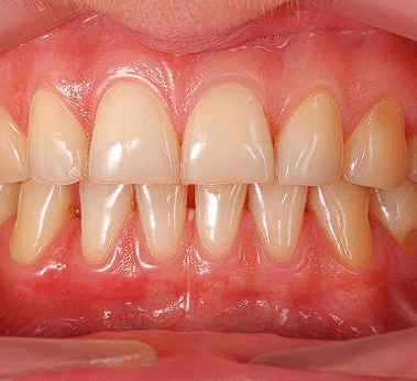 Periodontia